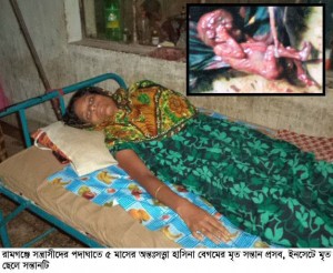 রামগঞ্জে মধ্যযুগীয় কায়দায় নির্যাতনের শিকার ৫ মাসের অন্তঃসত্ত্বা, রক্ষা পেলোনা তার গর্ভের সন্তান